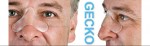 GECKO NASAL PAD RESMED