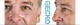 GECKO NASAL PAD RESMED